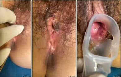 【医院泄密】来医院取白带做化验的小姐姐们❤️男友在门口等却不知医生在玩他女友的逼【20M】